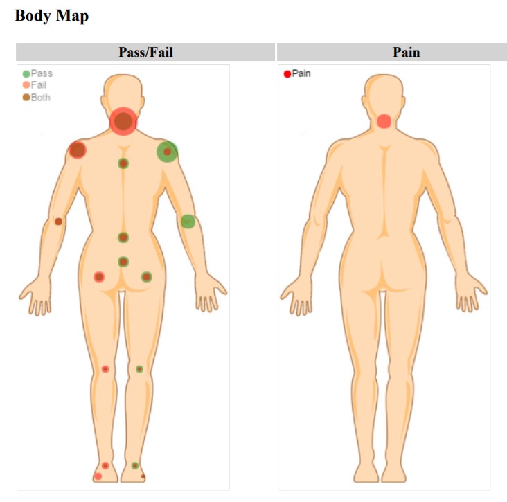 Exam Xoom body map showing pass/fail findings and pain locations across anterior and posterior views